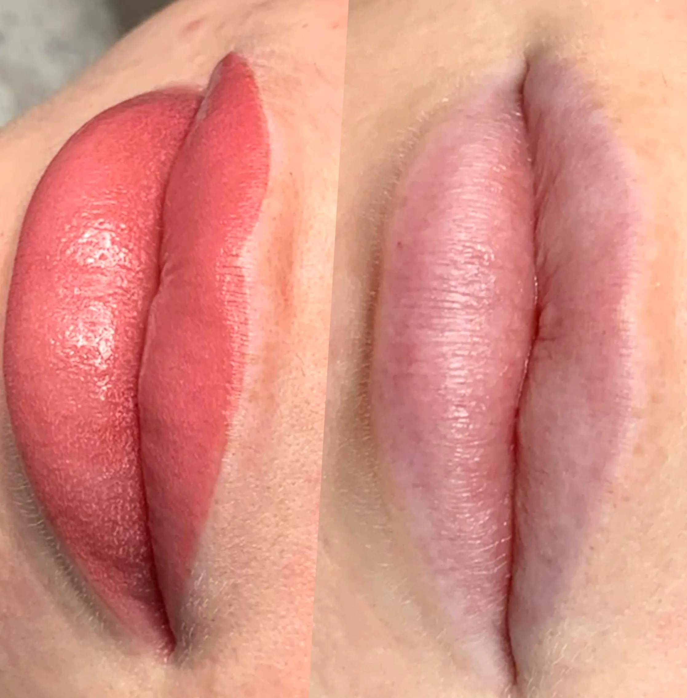 cold sore prevention